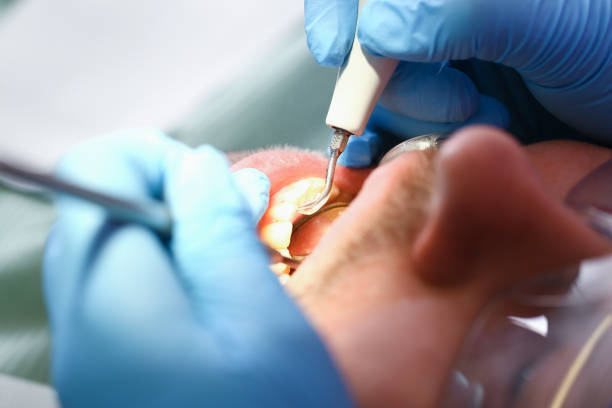 Best Emergency TMJ Treatment in Moraga, CA