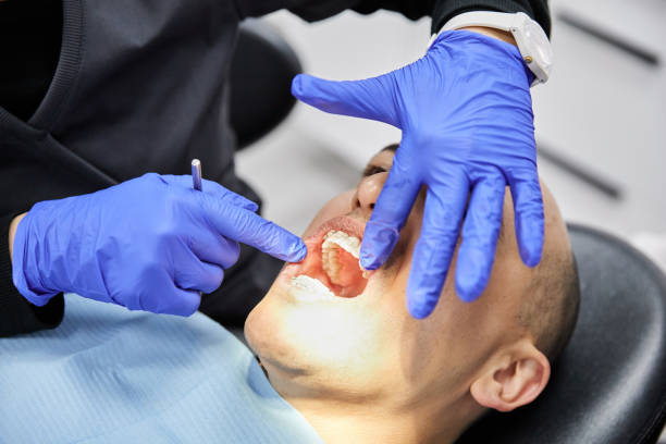 Best After-Hours Dental Trauma Care in Moraga, CA