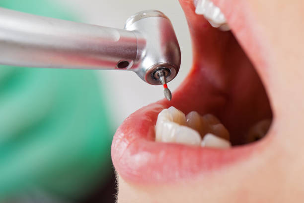 Best Emergency Denture Repair in Moraga, CA